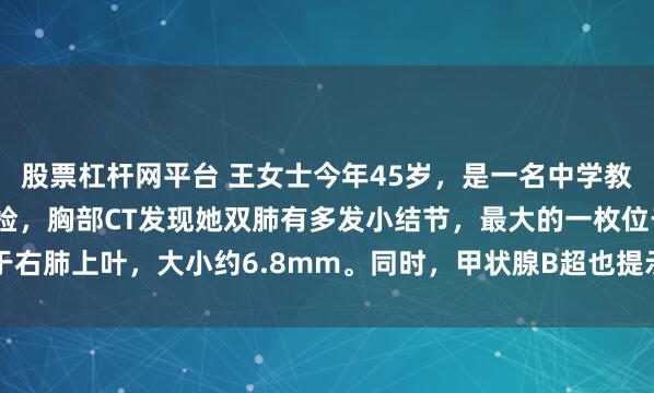 股票杠杆网平台 王女士今年45岁，是一名中学教师。去年学校组织的体检，胸部CT发现她双肺有多发小结节，最大的一枚位于右肺上叶，大小约6.8mm。同时，甲状腺B超也提示有数个小结节，评级为TI